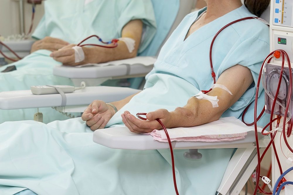 What Is Dialysis and When Would I Need It?