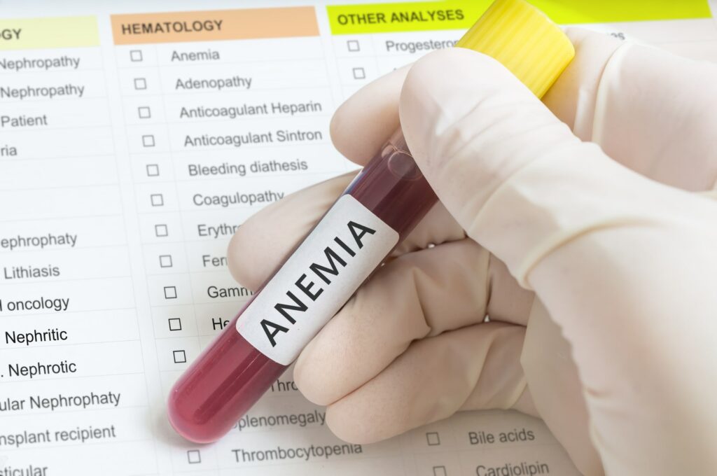 Anemia and Your Kidney Health